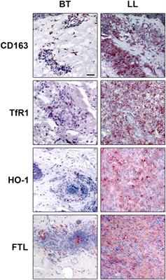 Innate Immune Responses in Leprosy